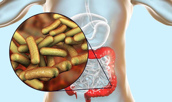Symptômes de Shigella: infection bactérienne de l'estomac
