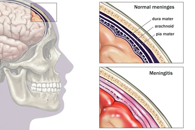 http://fmedic.org/wp-content/uploads/2020/12/1800ss_medicalimages_rm_brain_meninges_illustration.jpg