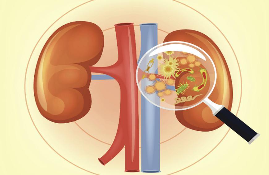 Infection R nale Sympt mes Causes Et Traitement Fmedic Infection R nale Sympt mes Causes Et Traitement Fmedic