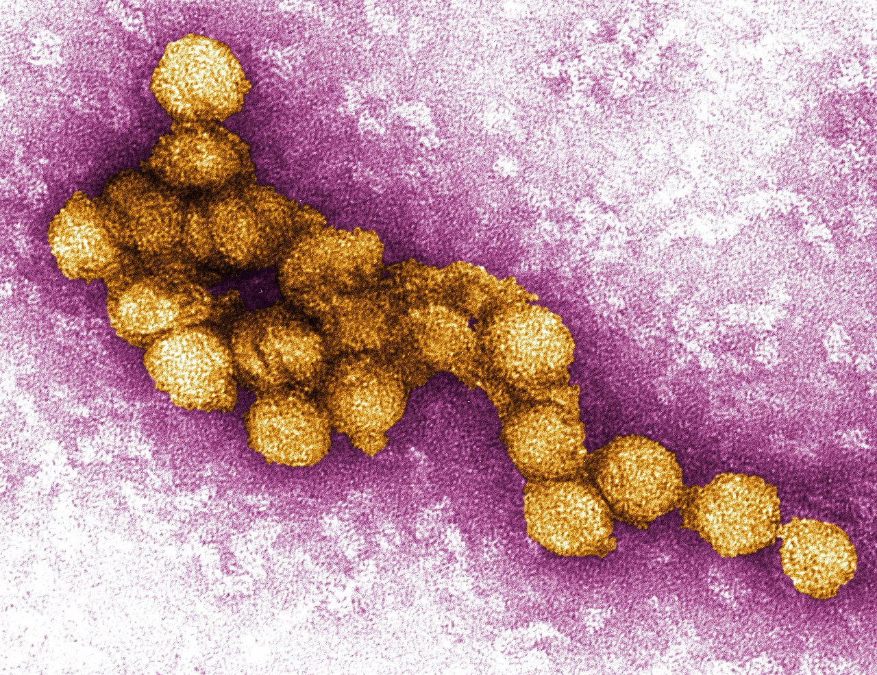 Virus du Nil occidental: symptômes et traitement