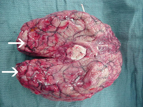 Une hémorragie et une nécrose étendues sont présentes dans le cerveau, principalement dans le cortex frontal.