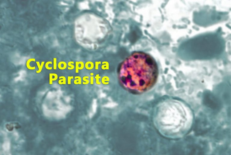 Infection à Cyclospora: symptômes, causes et traitement