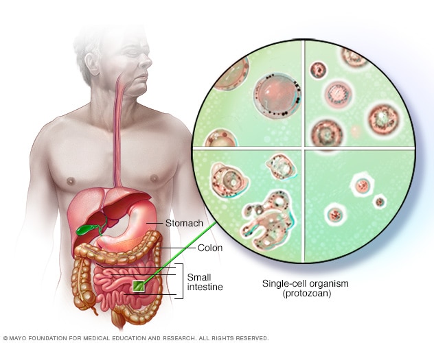 Blastocystis hominis - causes, symptômes et traitement