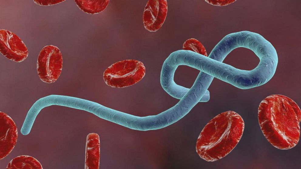 Virus Ebola et virus de Marburg