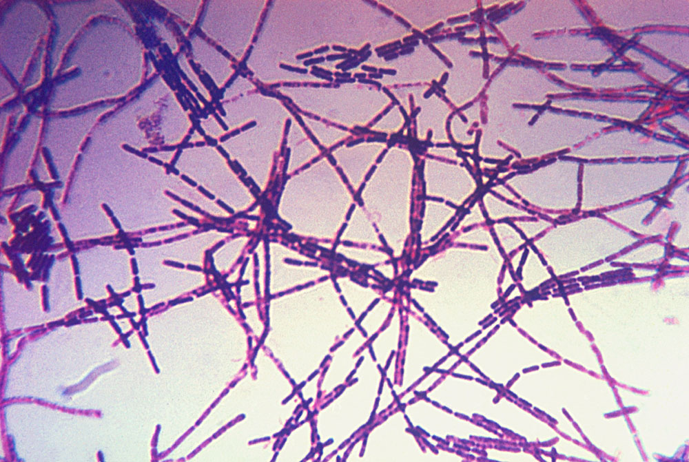 Bactérie Bacillus anthracis