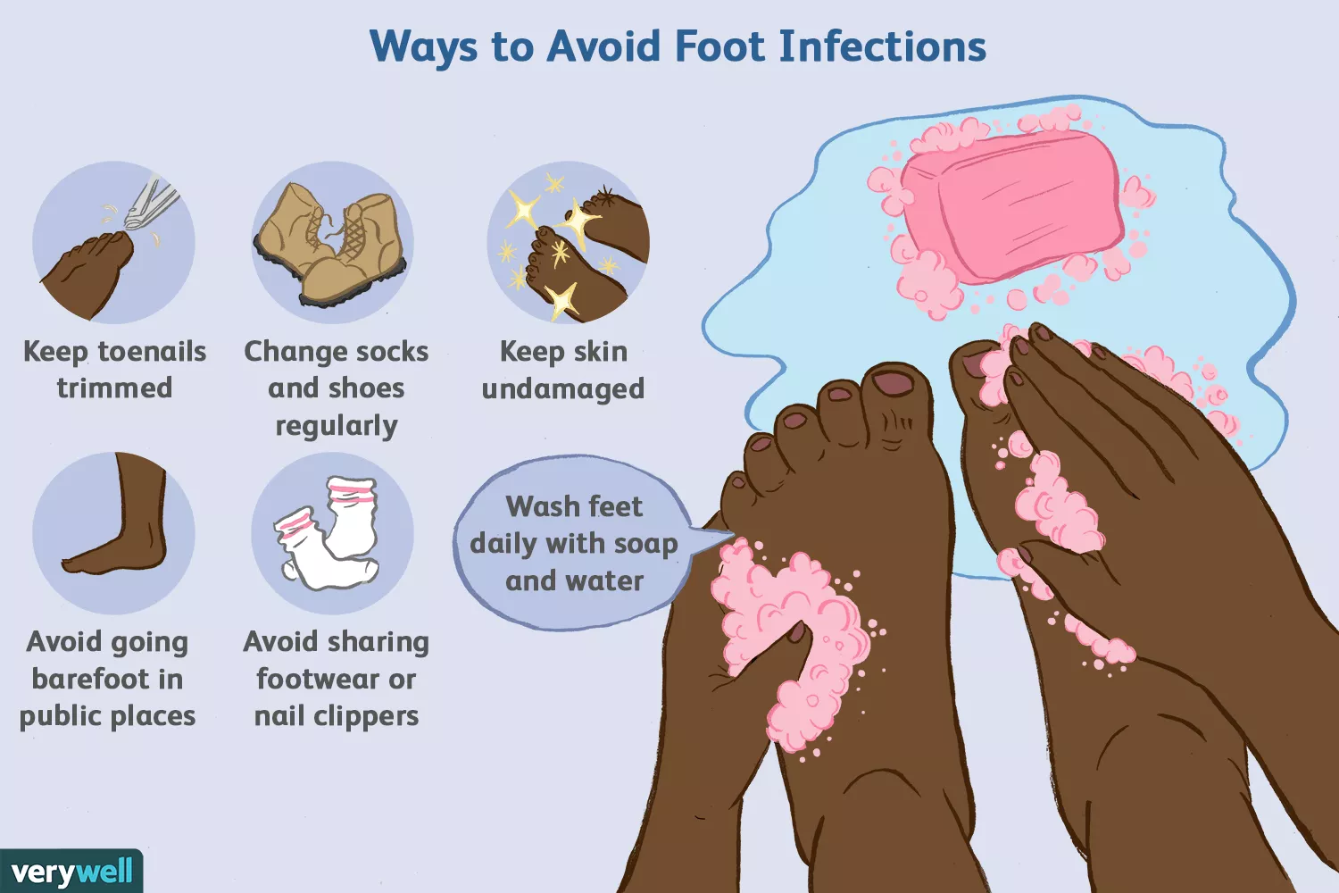 Façons d'éviter les infections des pieds
