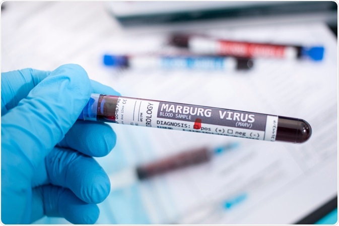 Virus de Marburg